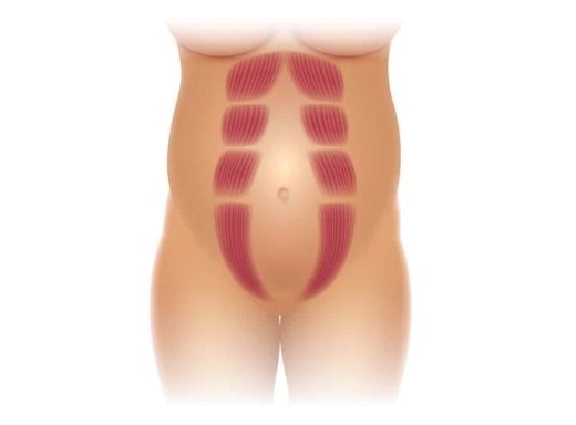 Diastasis Masterclass