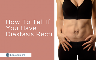 How To Tell If You Have Diastasis Recti