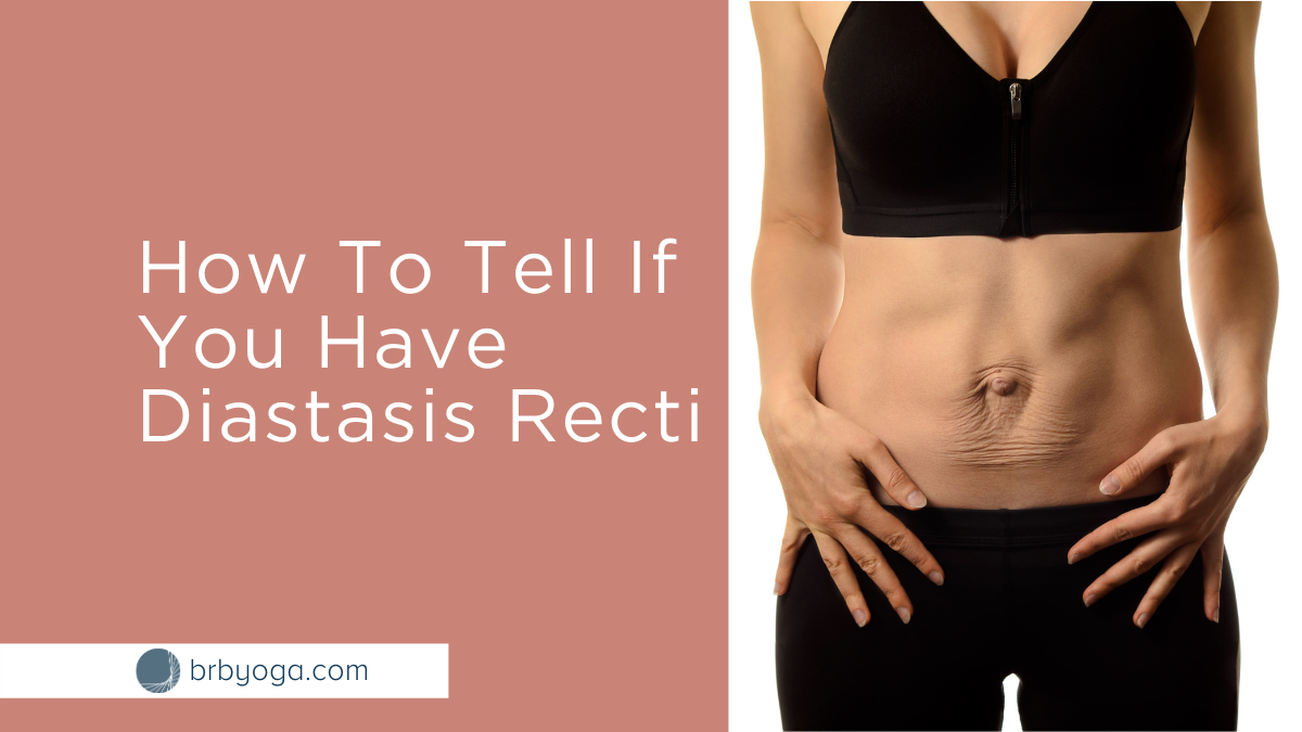 Diastasis recti: how do you know if you have it and what can you
